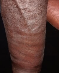 photo-thumb