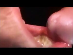 Thumb 7